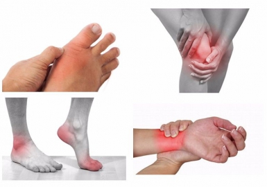 Understanding Arthritis - Symptoms