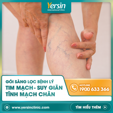 GÓI SÀNG LỌC BỆNH LÝ TIM MẠCH - SUY GIÃN TĨNH MẠCH CHÂN